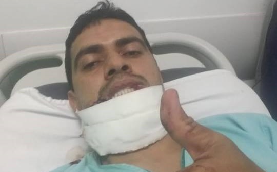 Jogo arrecada fundos para auxiliar policial que teve rosto desfigurado por pitbull